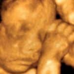 dijete na ultrazvuku