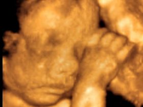 dijete na ultrazvuku